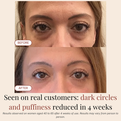 PDRN Eye Recovery Patches
