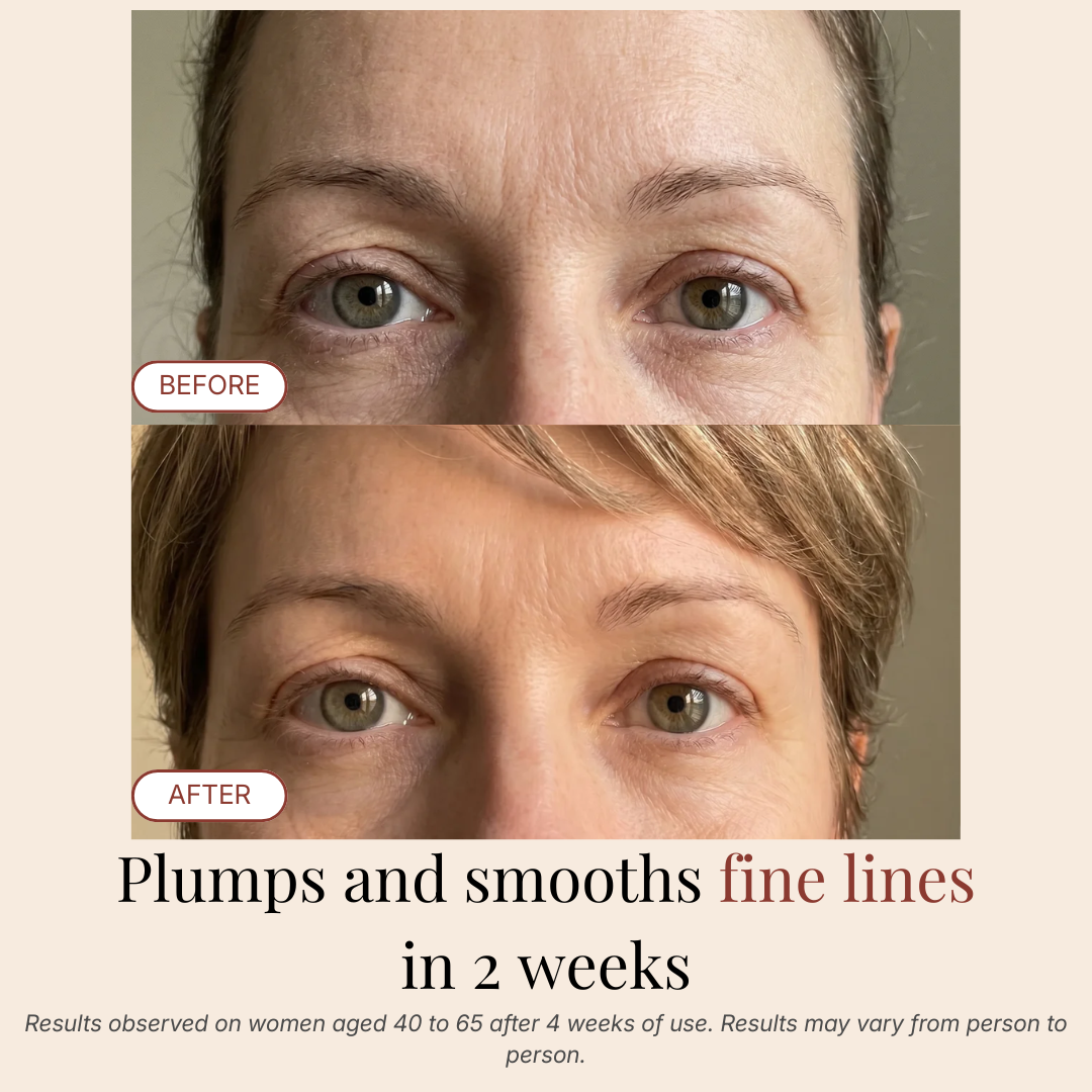PDRN Eye Recovery Patches