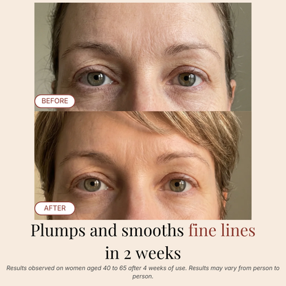 PDRN Eye Recovery Patches