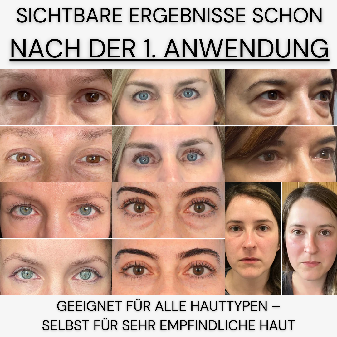 InstaLift Augenpflaster mit PDRN & Kollagen