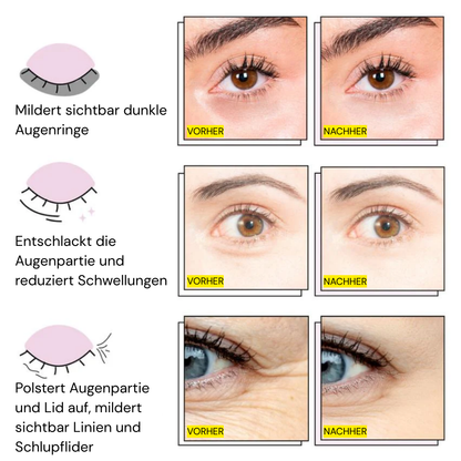 InstaLift Augenpflaster mit PDRN & Kollagen